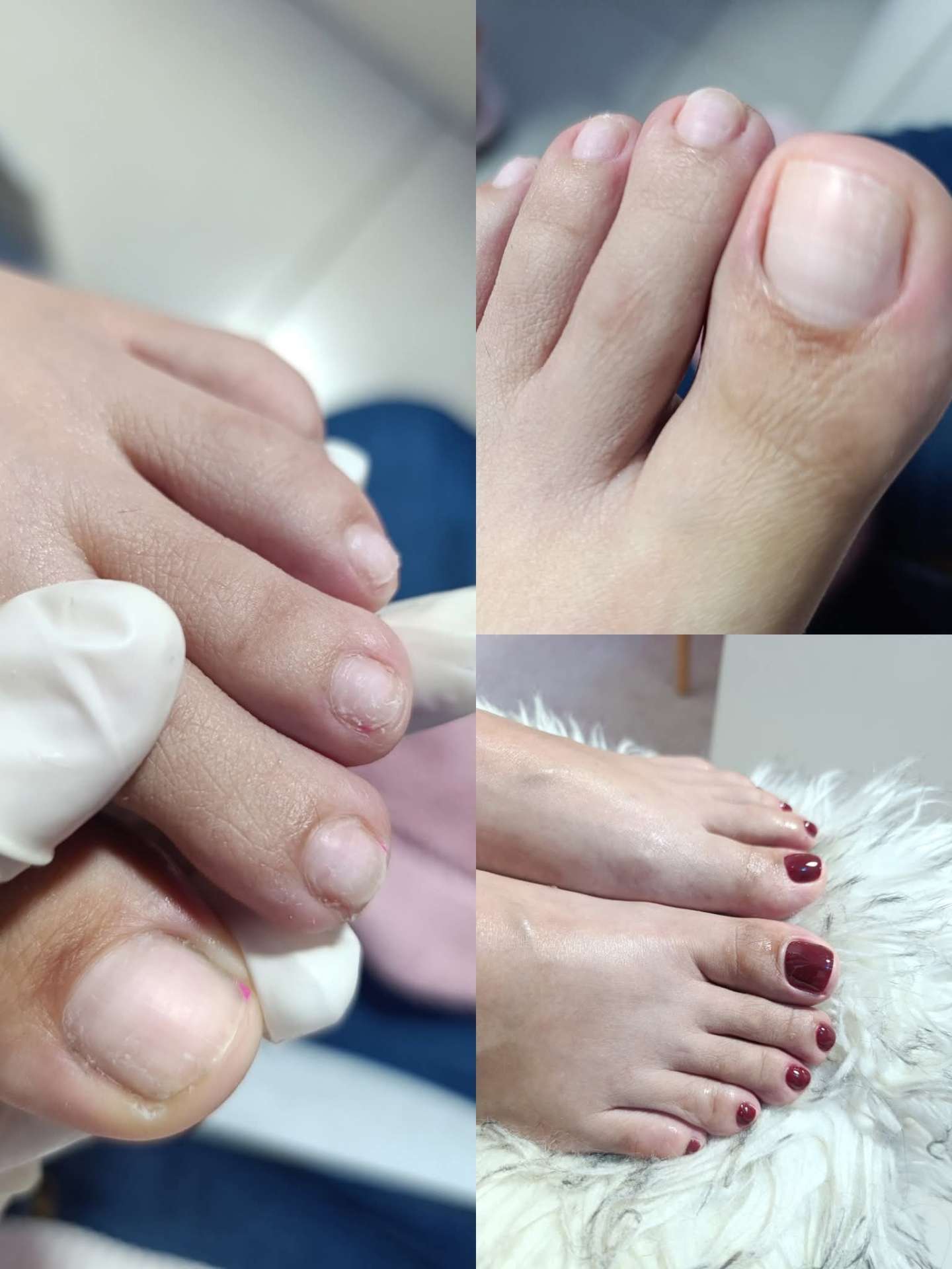 Pedicure spa antes y después